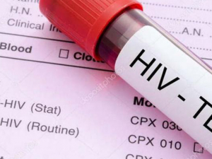 Dan a conocer horarios de atención para test rápido de VIH